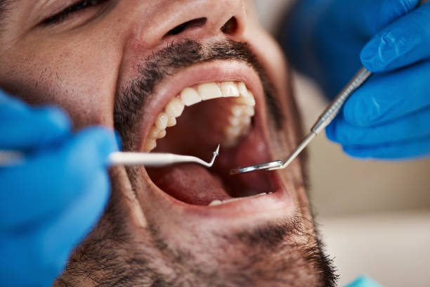 Best Emergency Dental Services for Seniors in North Potomac, MD