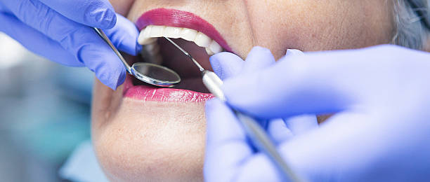 Best Emergency Dentist for Knocked-Out Tooth in North Potomac, MD